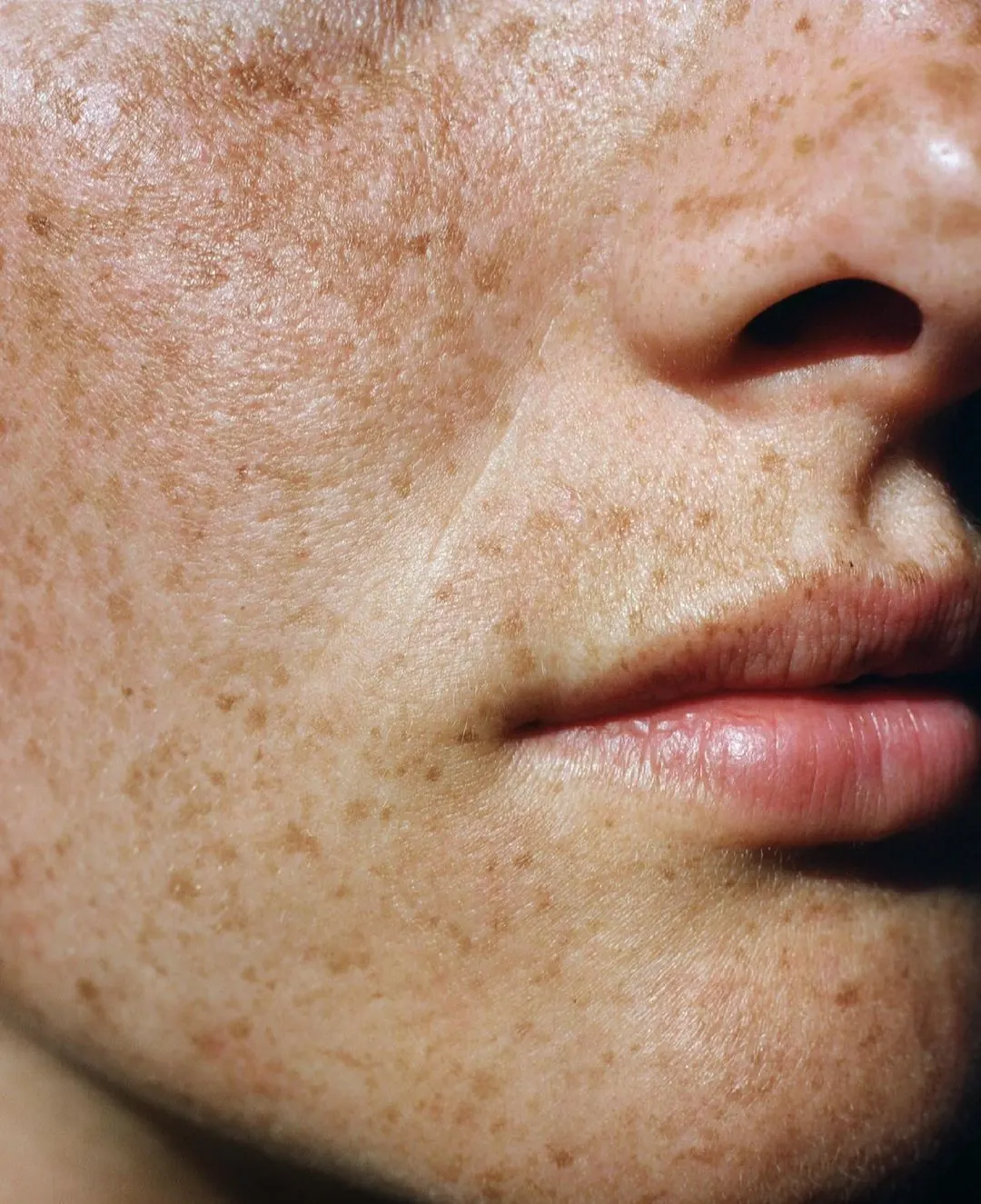 Editorial B&N — macro de mejilla y labios, rejuvenecimiento facial